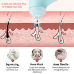 Electric Vacuum Blackhead Remover – Mini Facial Pore Cleaning Machine - Image 4